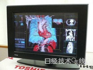 醫用裸眼3D顯示器，開始用于腦神經外科手術-廣州磐眾智能科技有限公司